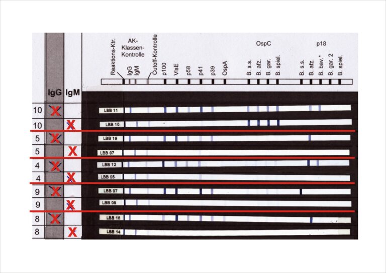 Borreliose Igm Positiv Igg Negativ www.labor-enders.de